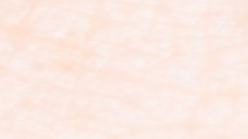 Bolsas debajo de los ojos