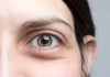 Ojeras