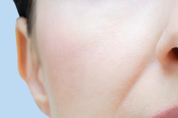 Surcos nasogenianos: cómo eliminarlos naturalmente con ejercicios y masajes faciales