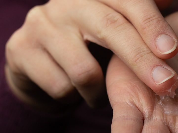 Despídete de las manos secas con vaselina: el tratamiento más fácil para probar en casa