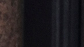 Kate Middleton es hospitalizada por una cirugía abdominal; lo que se sabe hasta el momento