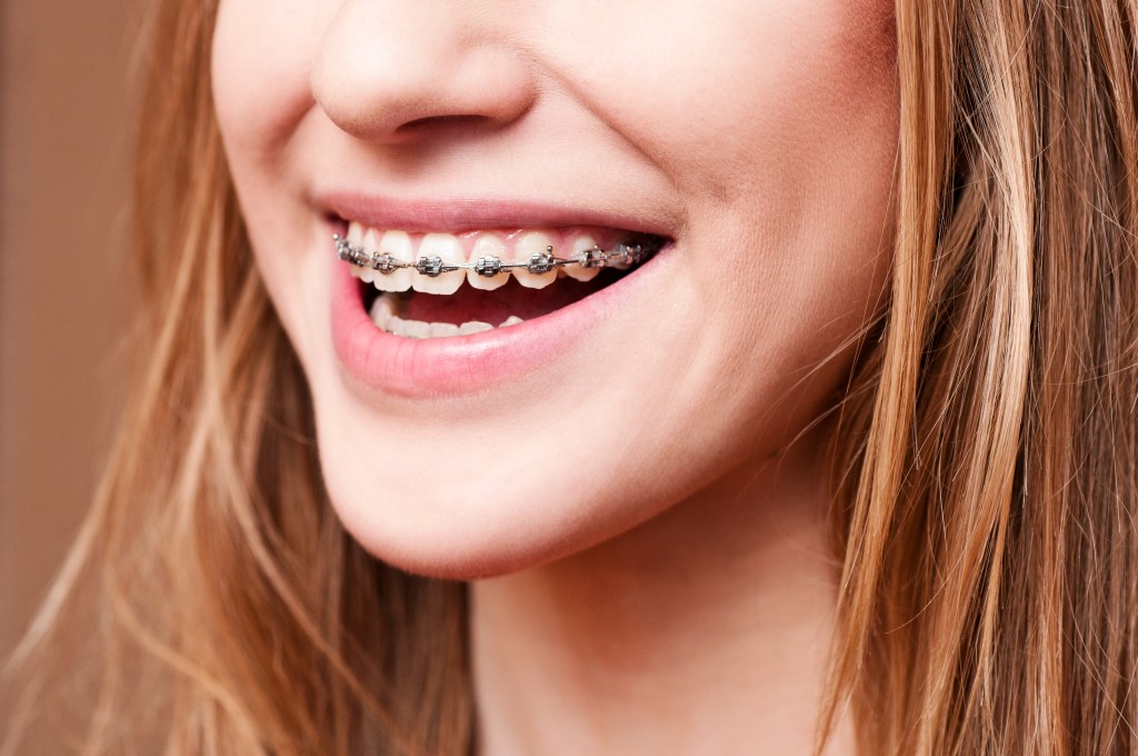 La cirugía maxilofacial puede ayudarte a corregir la mandíbula pronunciada.