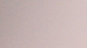 La arbutina es uno de los mejores componentes para reducir la melasma.