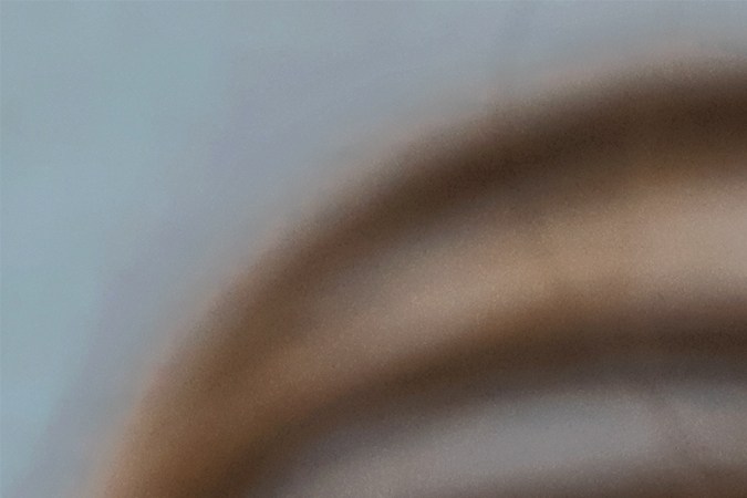 Las manchas en la piel pueden aparecer por brotes de acné o la exposición a rayos solares.