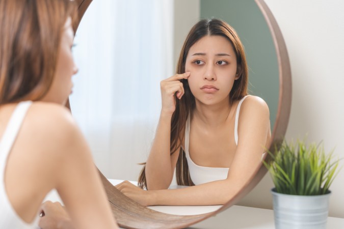 Diminuye tu rostro hinchado en las mañanas con los trucos adecuados.