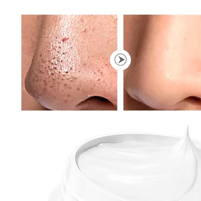 Nose Plants Pore Strips de Lambena