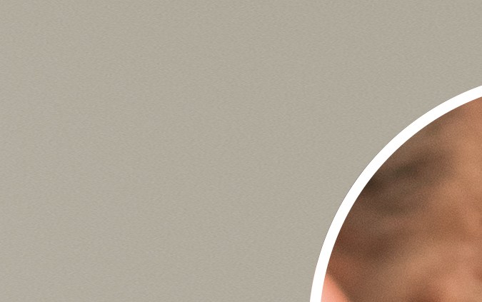 El sol puede favorecer la aparición de arrugas y manchas en la piel.