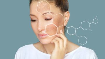 La Roche Posay presentó los productos ideales para combatir las manchas.