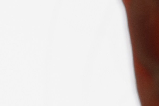 La piel grasa suele tener un aspecto brillante.