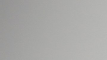 Evita la caspa en tu cabello al prevenir los factores que la desencadenan.