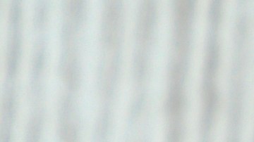 Evita los síntomas de la psoriasis con las cremas adecuadas.