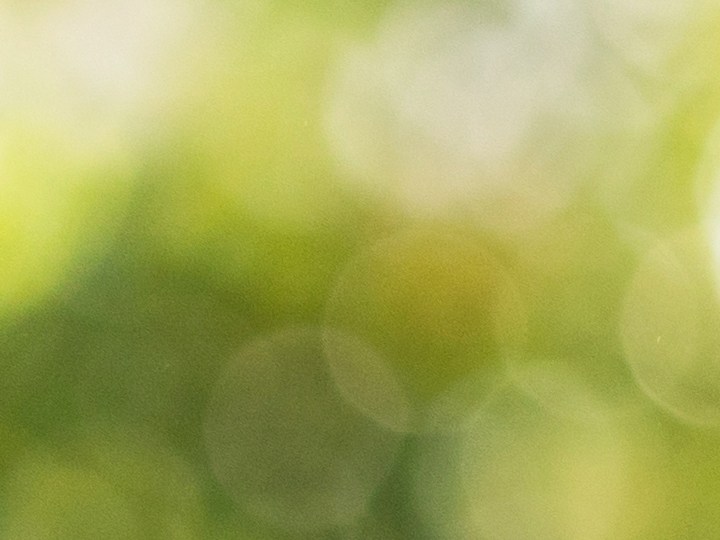 Cuida la piel grasa en el verano para evitar las imperfecciones.