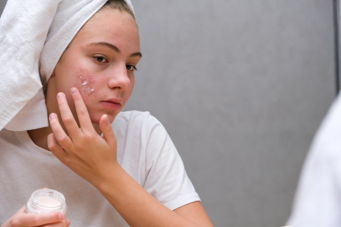 Limpia tu piel con productos que contengan seborreguladores.