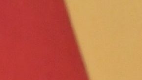 Kim Kardashian usa un procedimiento estético con esperma de salmón.