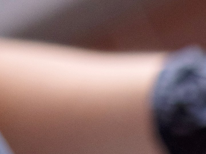 Una de las mejores formas de cuidar la piel es con un control dermatoscópico.