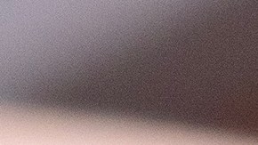 Una de las mejores formas de cuidar la piel es con un control dermatoscópico.