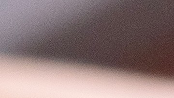 Una de las mejores formas de cuidar la piel es con un control dermatoscópico.