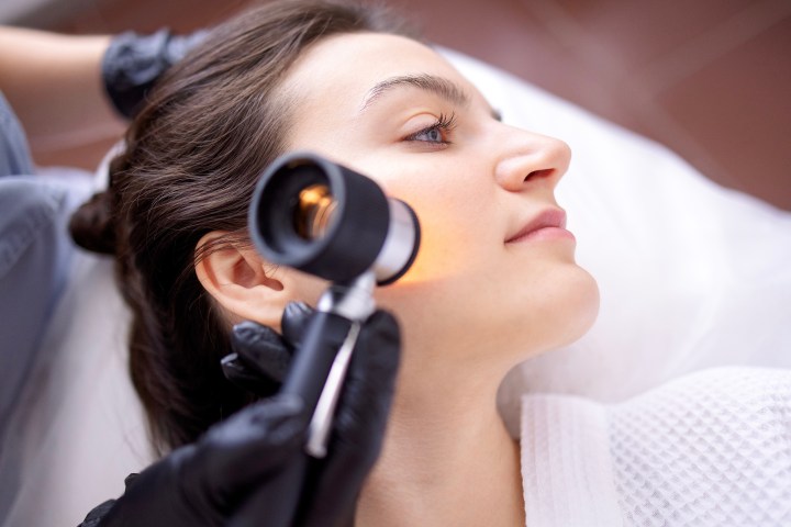 Una de las mejores formas de cuidar la piel es con un control dermatoscópico.