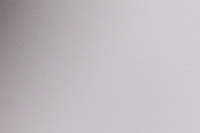 Acude con un dermatólogo especialista para realizar un control dermatoscópico.