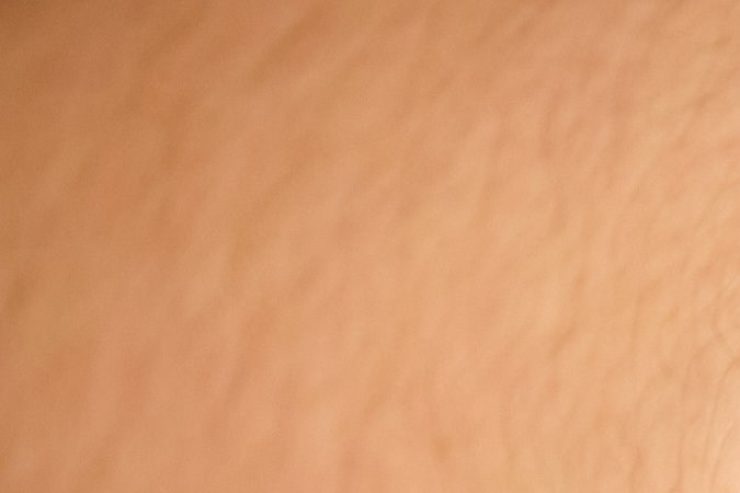 Retira la suciedad de tu piel con limpiadores suaves.