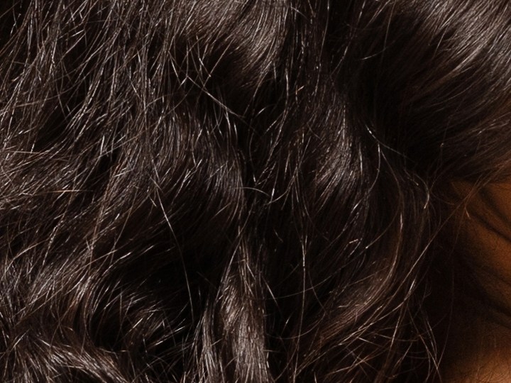 La dermatitis atópica debe cuidarse con una rutina adecuada.