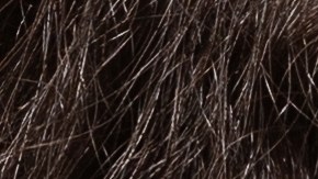 La dermatitis atópica debe cuidarse con una rutina adecuada.