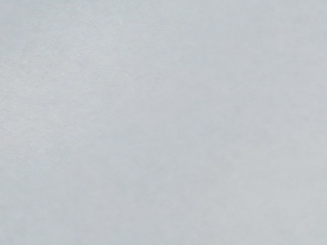 La caída abundante del cabello puede indicarte de un problema en el organismo.