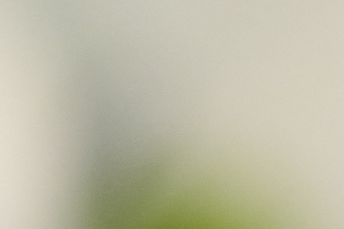 Los injertos capilares ayudan a recuperar el cabello.