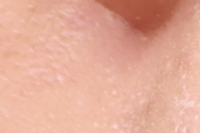 Evita aplicar los cosméticos directamente sobre el acné para no contaminarlo. 