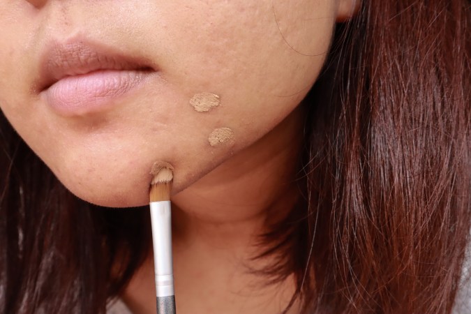 Evita aplicar los cosméticos directamente sobre el acné para no contaminarlo.