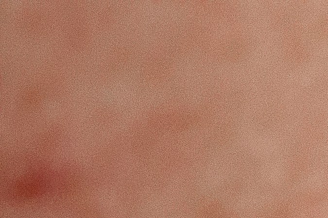 Evita los poros abiertos al incluir retinol en tu rutina.