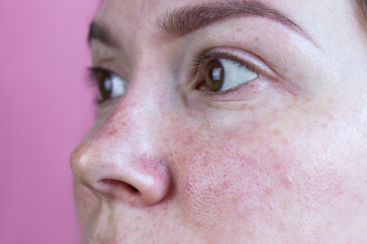 Evita los poros abiertos al mantener una correcta rutina de skincare.