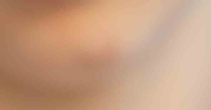 La tretinoína es un componente recomendado para combatir los brotes de acné.