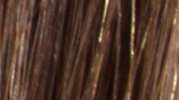 Los dermatólogos profesionales recomiendan la tretinoína en pieles con acné.