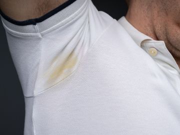 Las manchas amarillas deben eliminarse con los trucos adecuados en la ropa blanca.