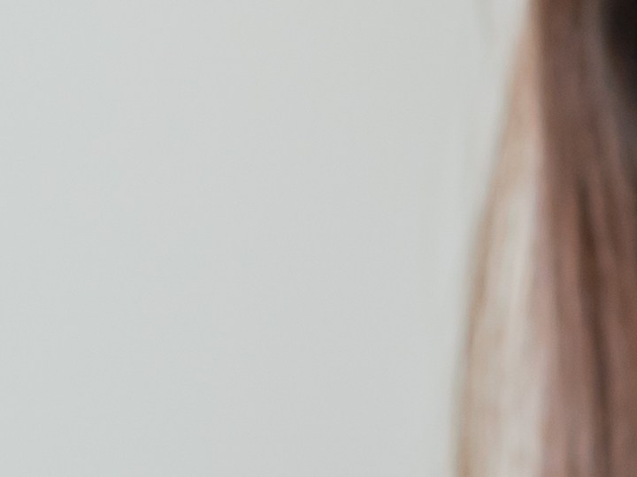 La caída del cabello