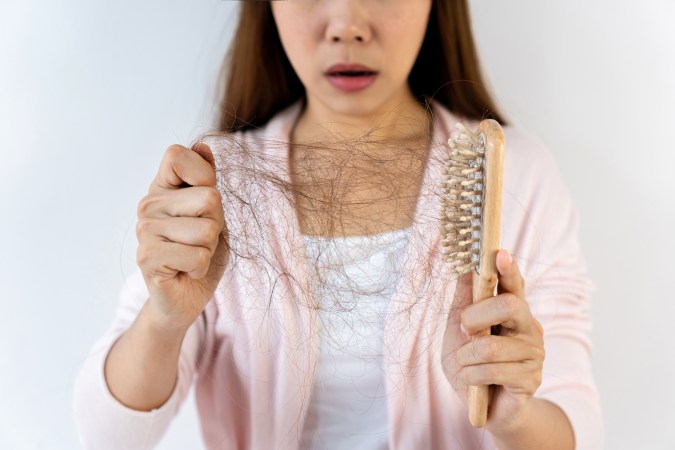 El cabello se cae con la pérdida de estrógenos en el post parto.