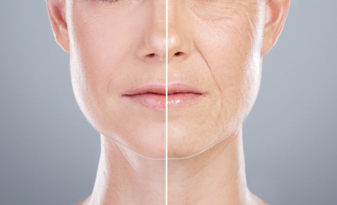 Mujeres que consumieron la curcumina microencapsulada notaron una reducción en las arrugas de su rostro.