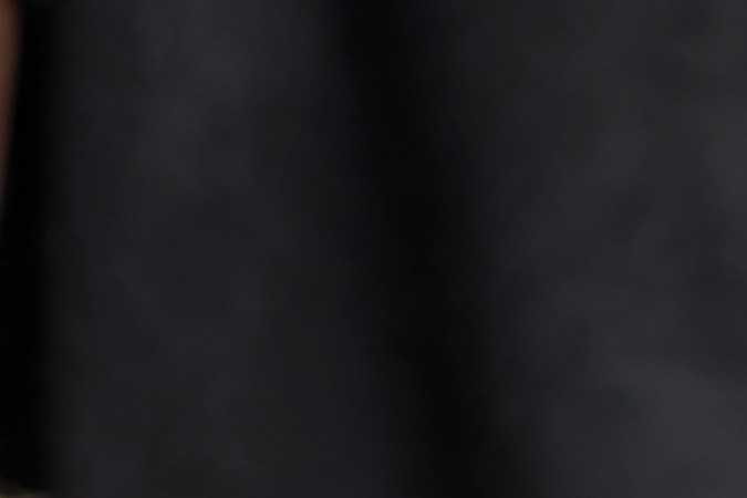 El eczema puede generar más ardor y picazón en pieles oscuras. 