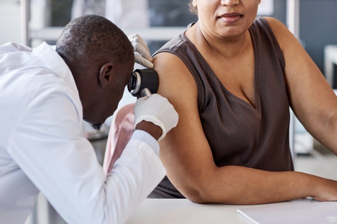 El eczema puede ser diagnosticado con mayor dificultad en pieles oscuras.