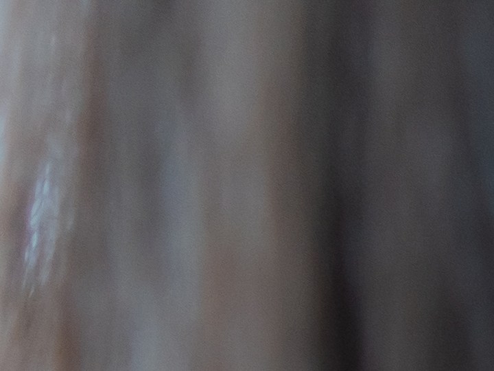 Las axilas oscuras deben cuidarse adecuadamente para reducir las manchas.