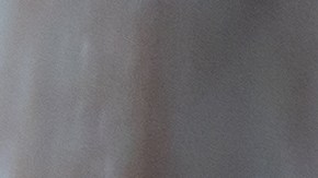 Las axilas oscuras deben cuidarse adecuadamente para reducir las manchas.