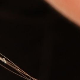 El peeling de fenol causa revuelo en redes sociales por el riesgo que representa para la piel.