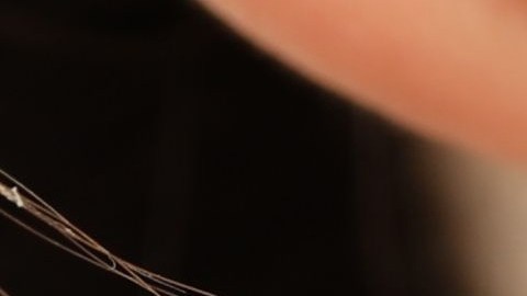 El peeling de fenol causa revuelo en redes sociales por el riesgo que representa para la piel.