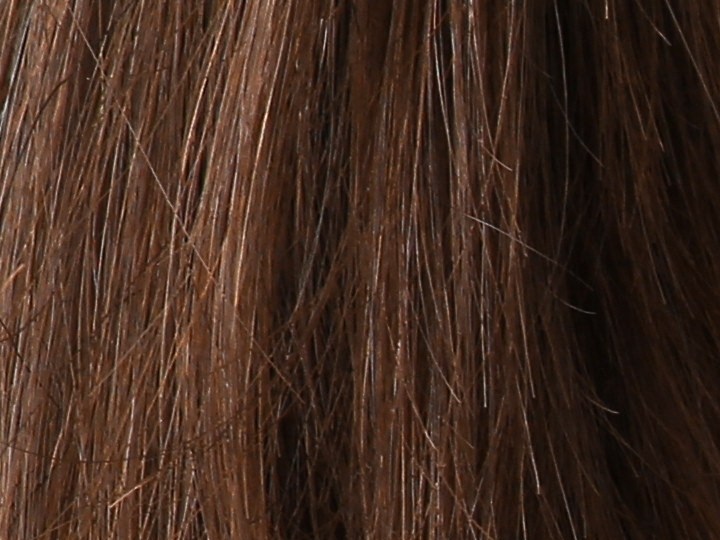 Febrero es el mes para crear consciencia sobre cómo prevenir el cáncer de piel.